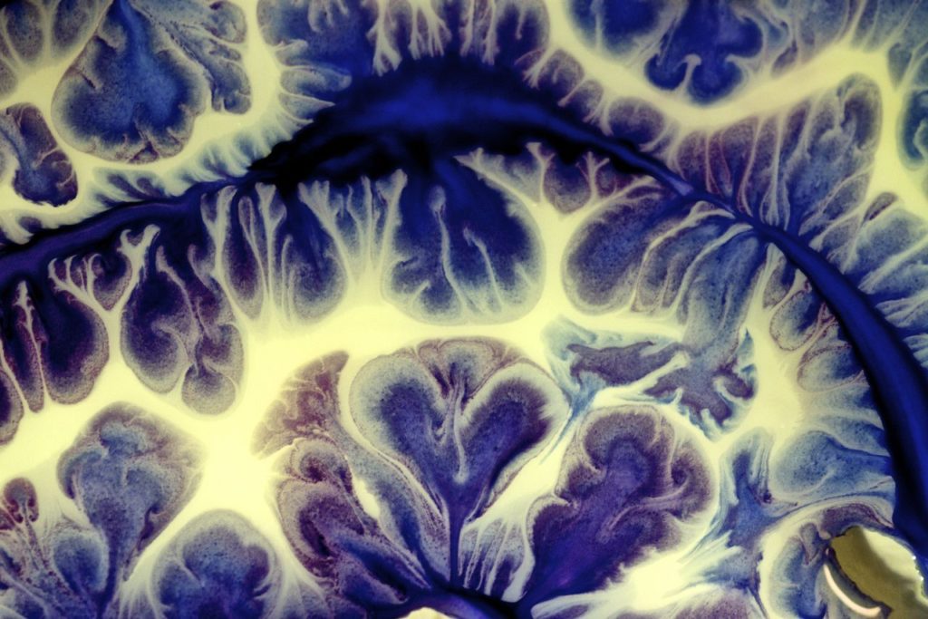 "Liquid Divisions" by P Burge