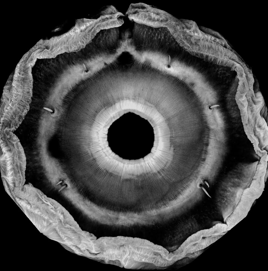 The net-winged midge's suction cup imaged with laser scanning confocal microscopy.