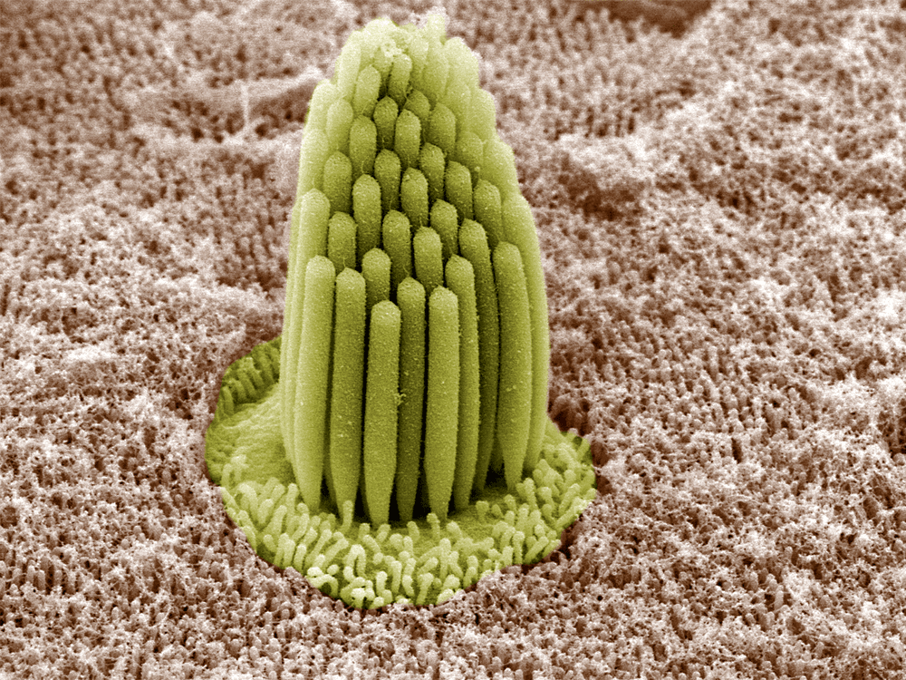 Inside an Ear