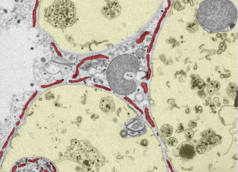 An artificially-colored micrograph highlights the different structures inside Spirostomum ambiguum. The red strings are a membrane-like endoplasmic reticulum entangled between yellow, fluid-filled vacuoles.